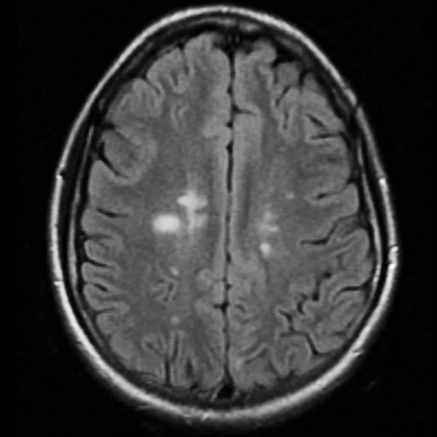 CCMR image of a brain in cross-section